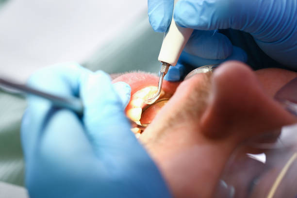 Best Emergency Treatment for Jaw Pain or Injury in East Farmingdale, NY